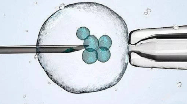 試管嬰兒治療方案確定