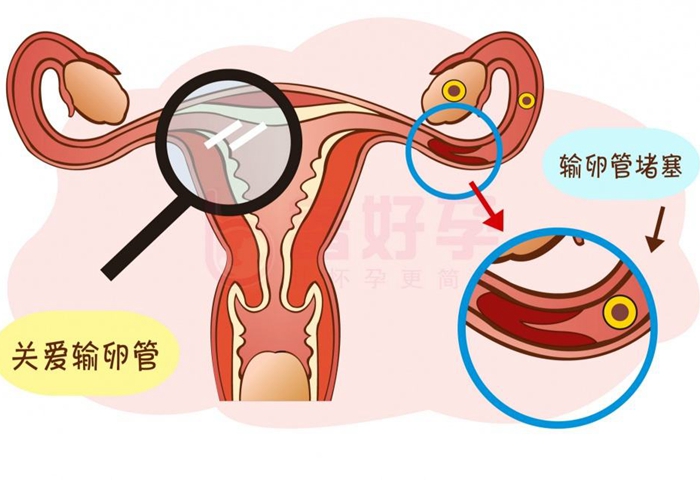 上海長(zhǎng)征醫(yī)院試管嬰兒