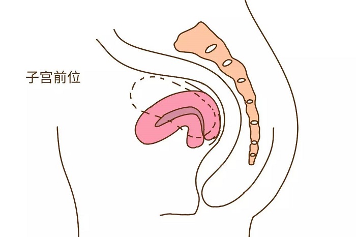 子宮前位示意圖