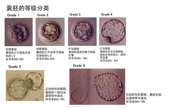 3bb4bc囊胚質(zhì)量怎么樣